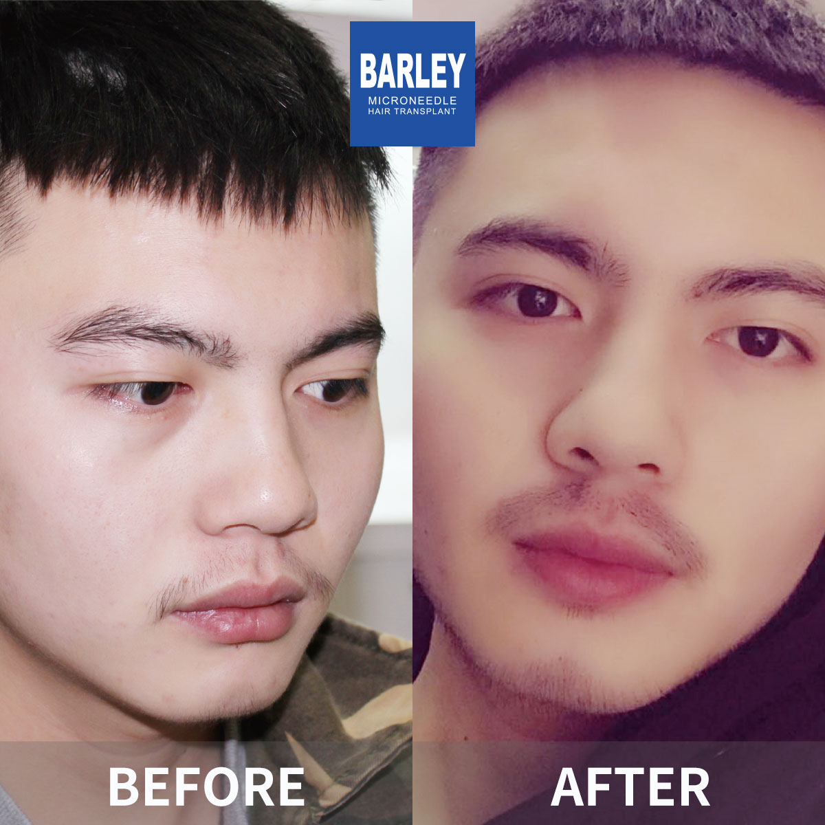 鬍子