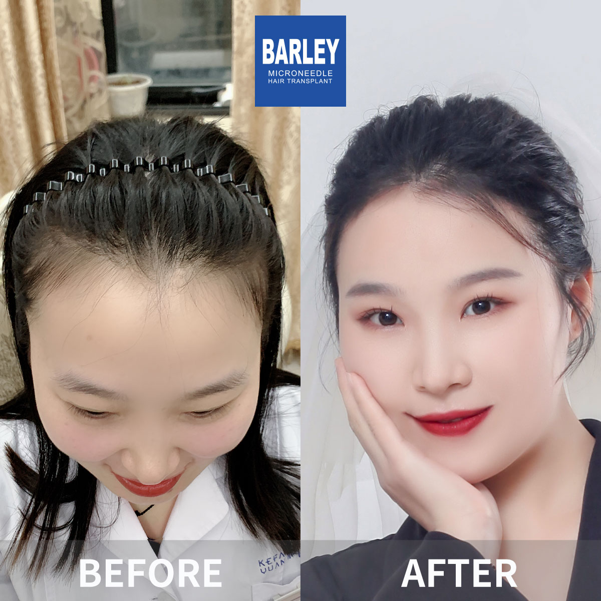女性頭髮