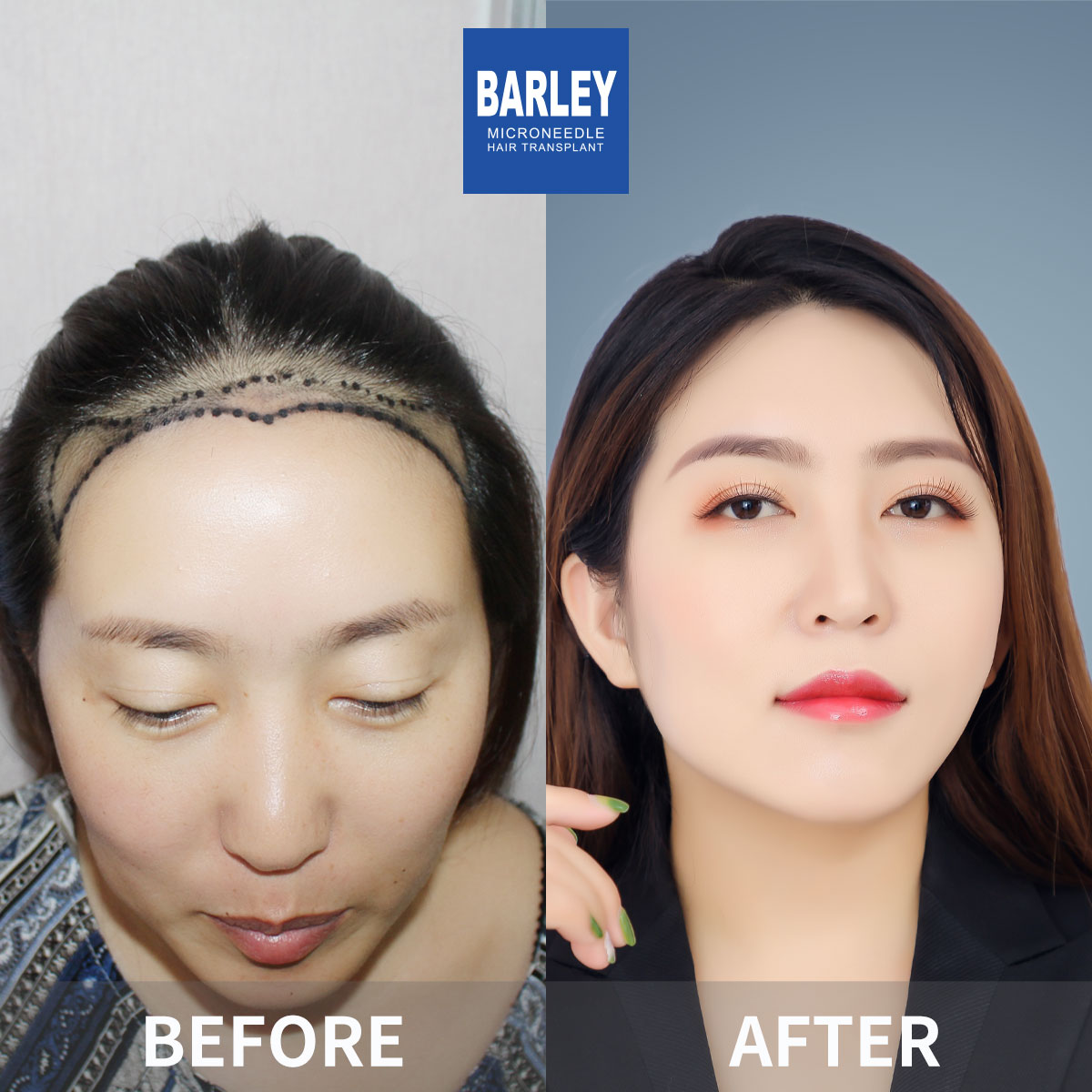 女性毛髮