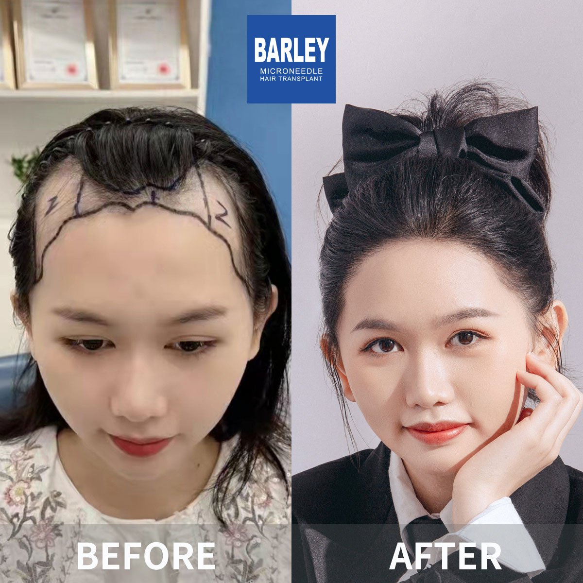 女性毛髮
