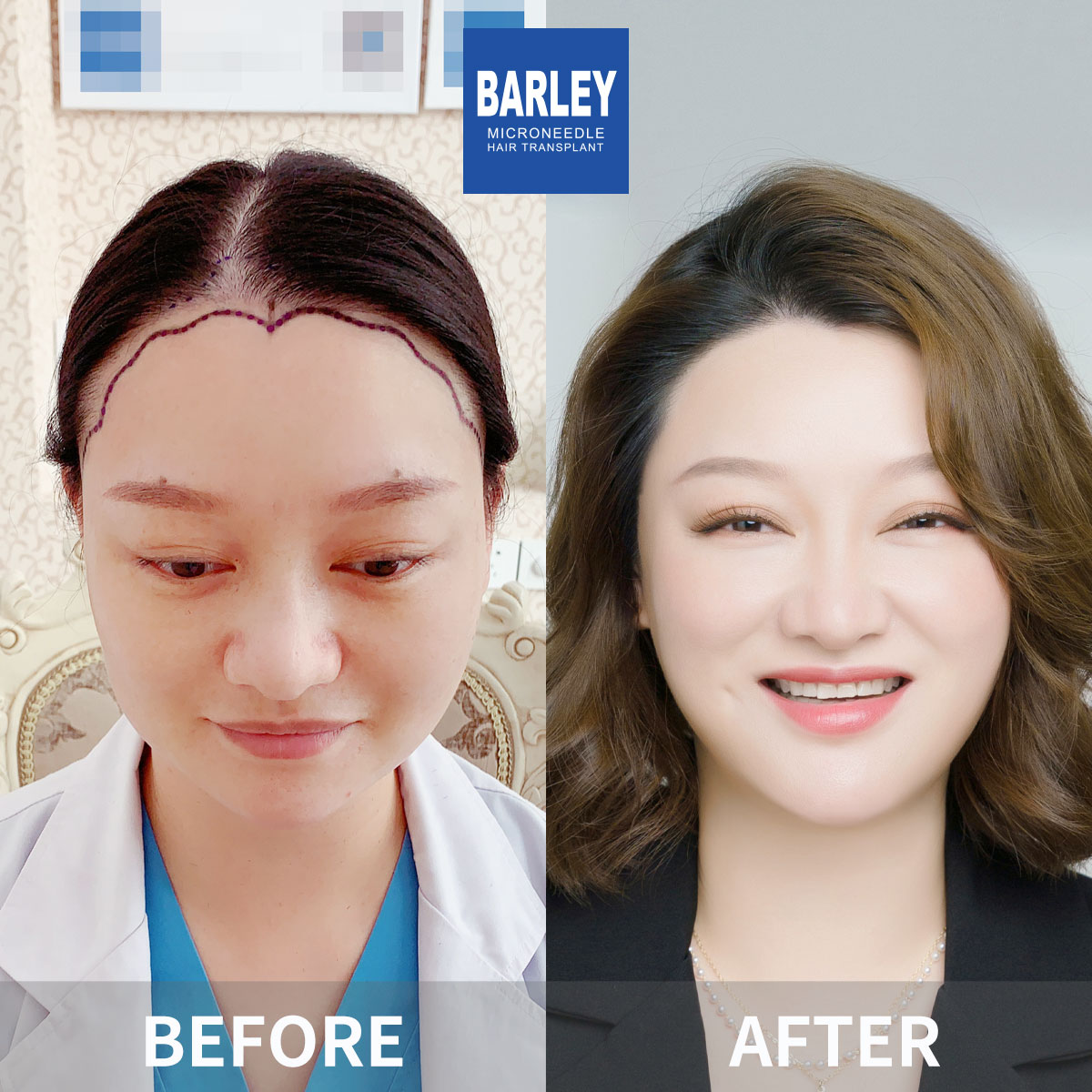 女性頭髮