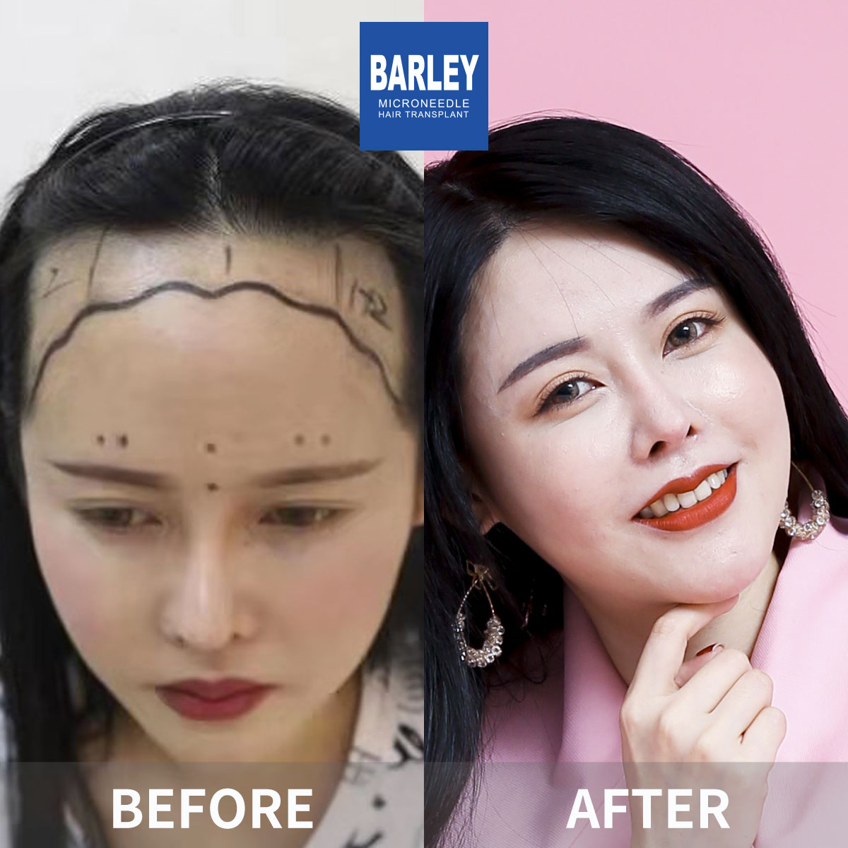 女性毛髮