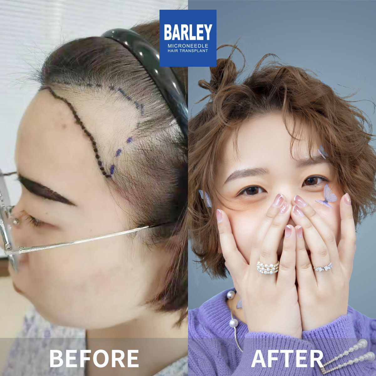 女性毛髮