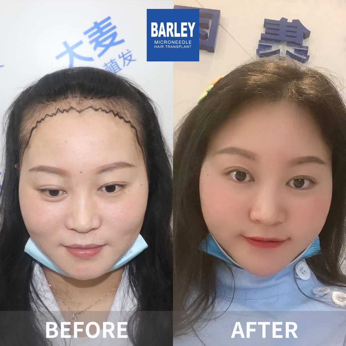 女性毛髮