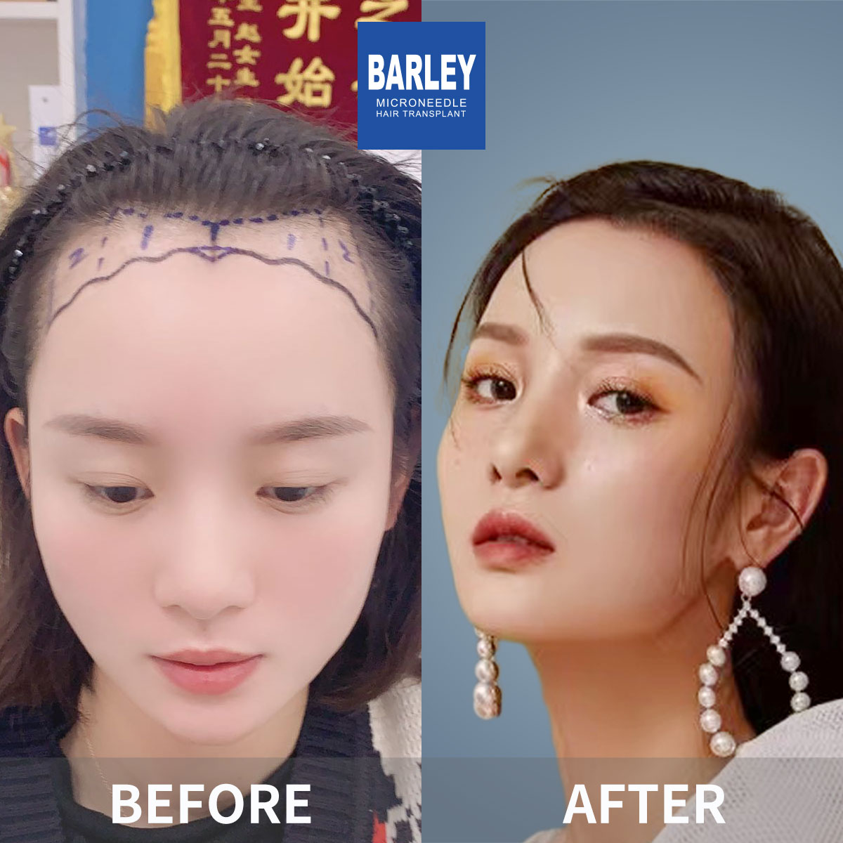 女性頭髮