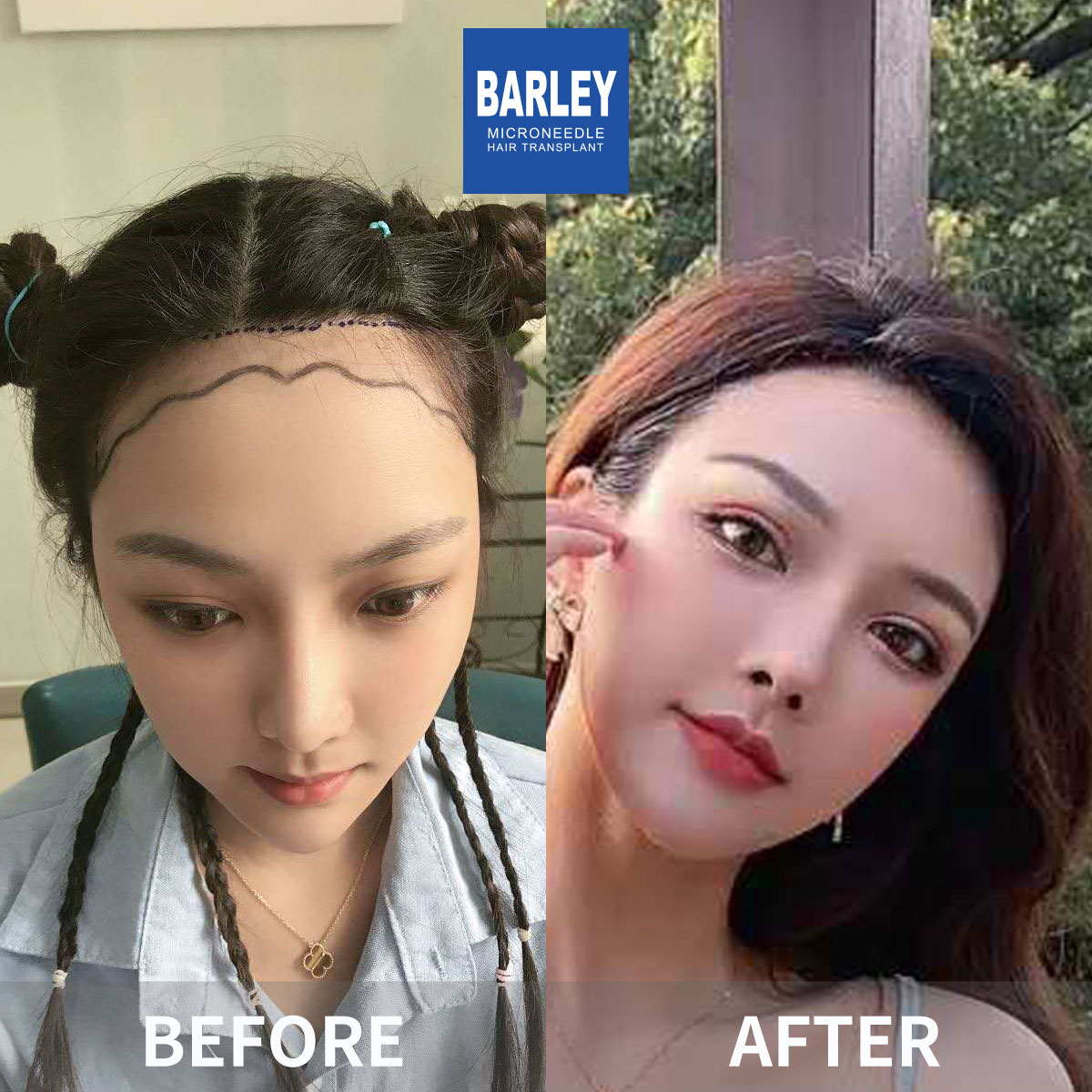 女性毛髮