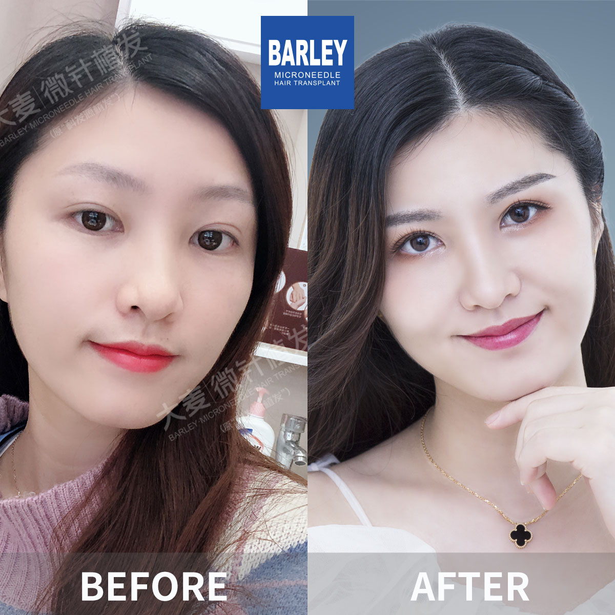 女性頭髮