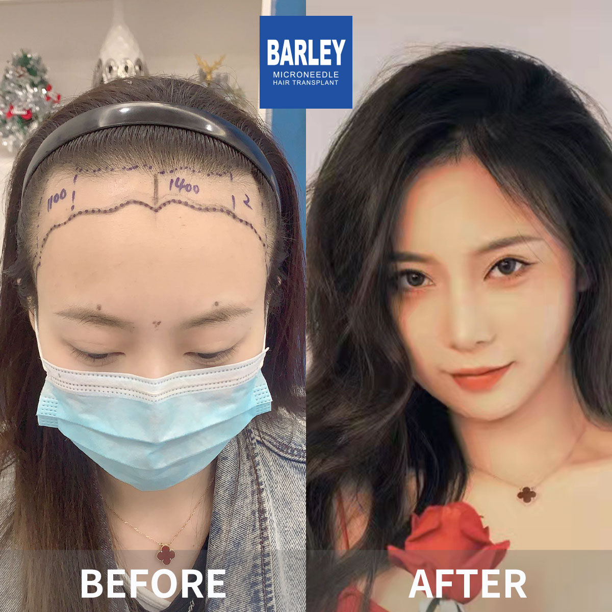 女性毛髮