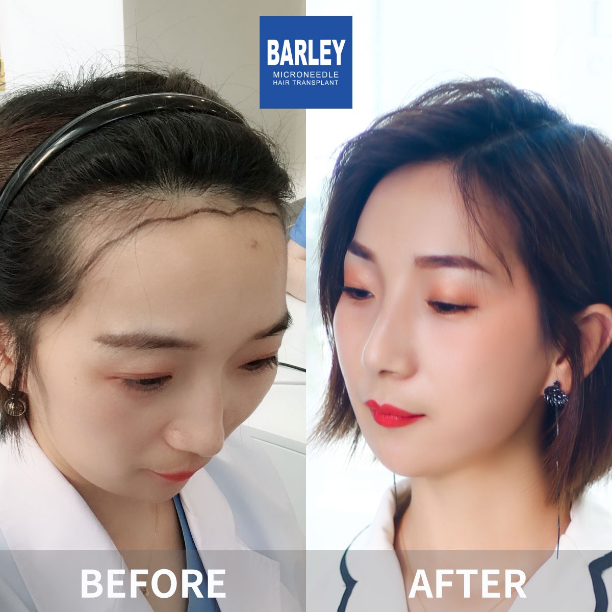 女性毛髮